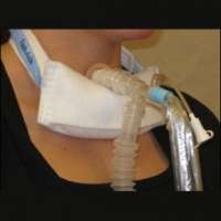 Marpac Trach-Aide, Stabilizes Trach Product Image