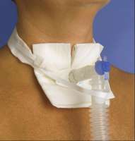 One-Piece Adult Trach-Tie with Ventilator Anti-disconnect Device Product Image